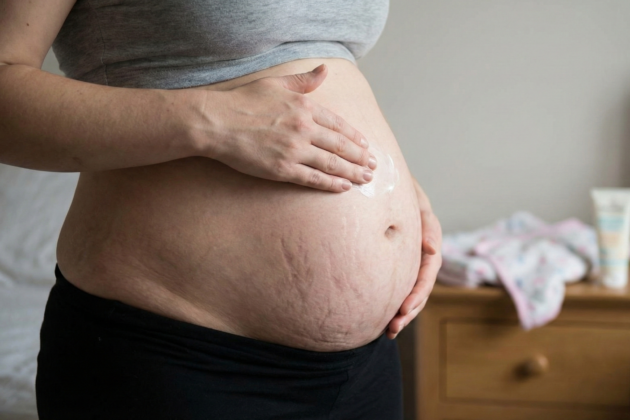איך לטפל בעור העודף אחרי הלידה